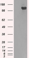 BubR1 Antibody