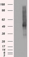 SLC18A2 Antibody