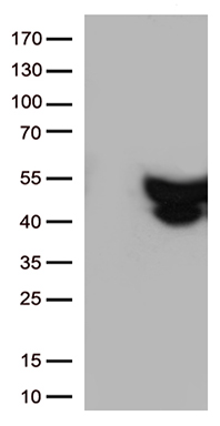 GFAP Antibody