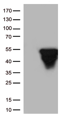 GFAP Antibody
