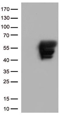 GFAP Antibody