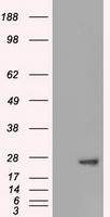 Adenylate Kinase 1 Antibody
