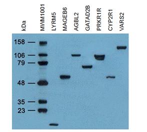 DDK (FLAG) Antibody