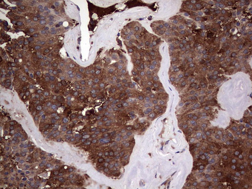 PKM2 Antibody