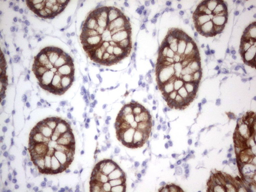 Acidic CK Antibody