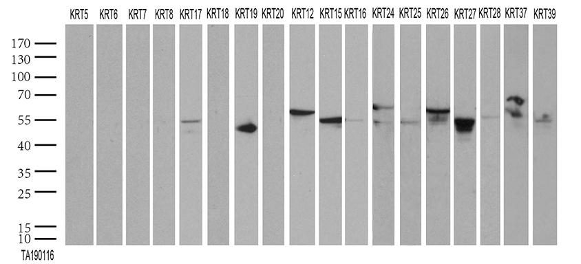 Acidic CK Antibody