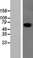 B4galt3 Mouse Over-expression Lysate