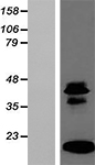Hba-a1 Mouse Over-expression Lysate