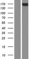 ABCC10 Human Over-expression Lysate