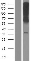 GPR177 (WLS) Human Over-expression Lysate