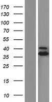 MDH1 Human Over-expression Lysate