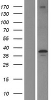 LIMS1 Human Over-expression Lysate