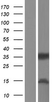 CD32B (FCGR2B) Human Over-expression Lysate