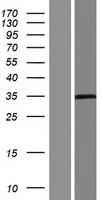 Trypsin (PRSS3) Human Over-expression Lysate