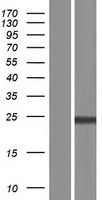 SDOS (NUDT16L1) Human Over-expression Lysate