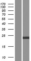 RhoGDI (ARHGDIA) Human Over-expression Lysate