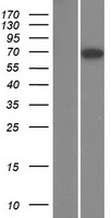 TBC1D17 Human Over-expression Lysate