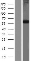 Glucose 6 phosphate isomerase (GPI) Human Over-expression Lysate