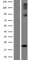 SLC38A6 Human Over-expression Lysate