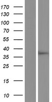 RSKR Human Over-expression Lysate