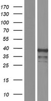 ZIC4 Human Over-expression Lysate