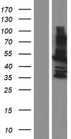 MAGEA8 Human Over-expression Lysate