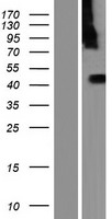 C9orf86 (RABL6) Human Over-expression Lysate