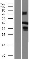 MBNL3 Human Over-expression Lysate