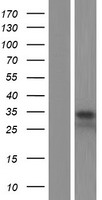VDAC2 Human Over-expression Lysate