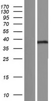 MBNL3 Human Over-expression Lysate