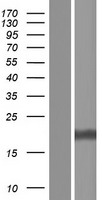 RPS27A Human Over-expression Lysate
