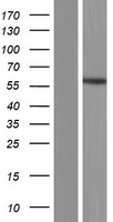Estrogen Related Receptor beta (ESRRB) Human Over-expression Lysate