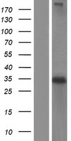 NAT1 Human Over-expression Lysate
