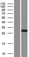 SSX2 (SSX2B) Human Over-expression Lysate