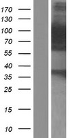 Palladin (PALLD) Human Over-expression Lysate