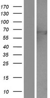 Glypican 3 (GPC3) Human Over-expression Lysate