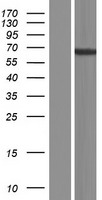TENR (ADAD1) Human Over-expression Lysate
