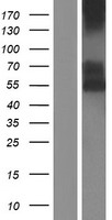 CD39 (ENTPD1) Human Over-expression Lysate