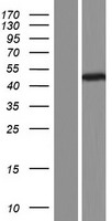 TUBB8 Human Over-expression Lysate