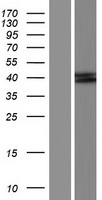 Aminomethyltransferase (AMT) Human Over-expression Lysate