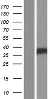RAD51 Human Over-expression Lysate