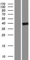 PCYT1B Human Over-expression Lysate