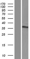 ZNF705G Human Over-expression Lysate