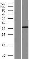 ARL13A Human Over-expression Lysate