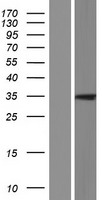 PLAAT5 Human Over-expression Lysate