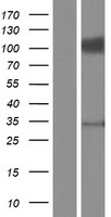 Endomucin (EMCN) Human Over-expression Lysate