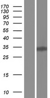 KLF6 Human Over-expression Lysate