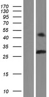 Class A basic helix loop helix protein 9 (BHLHA9) Human Over-expression Lysate