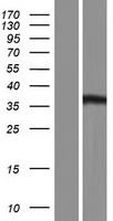 HOMER3 Human Over-expression Lysate