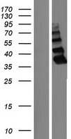 ZBTB8B Human Over-expression Lysate